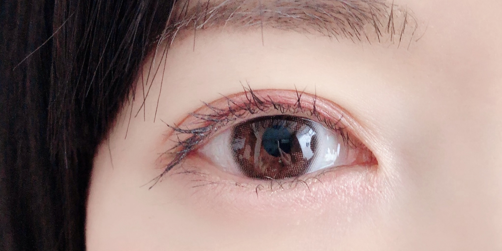 涙が止まらないのは実は逆さまつ毛が原因かも
