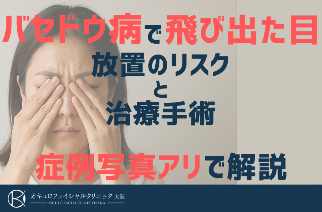 バセドウ病で眼球突出するのはなぜ？目が飛び出る原因と治療法を解説｜オキュロフェイシャルクリニック大阪