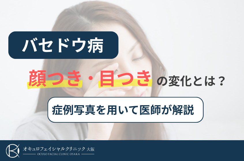 バセドウ病の顔つき、目つきの変化とは？症例写真を用いて医師が解説