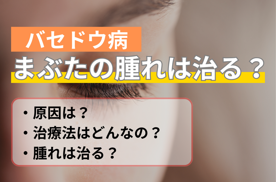 バセドウ病によるまぶたの腫れは治る？原因や治療法をわかりやすく解説