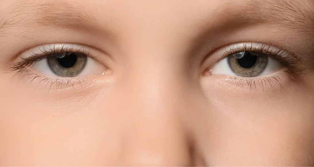 生まれつき眼瞼下垂の子供の特徴は？