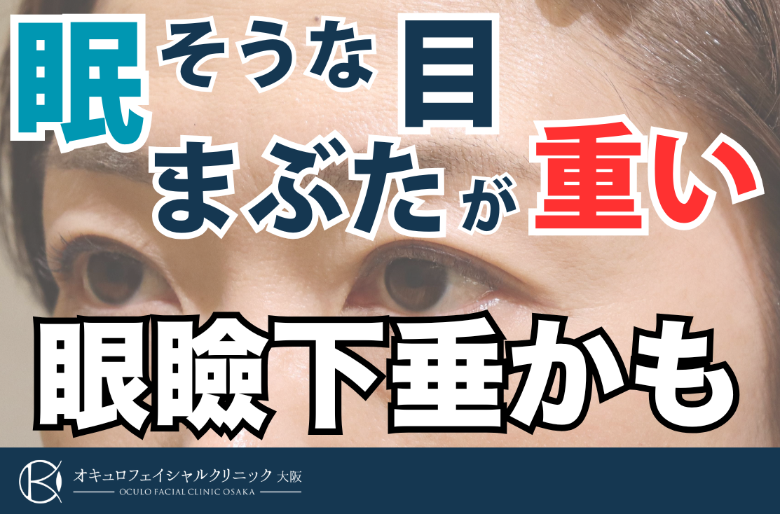 眠そうな目やまぶたが下がってきて重い人、その症状眼瞼下垂かもしれません