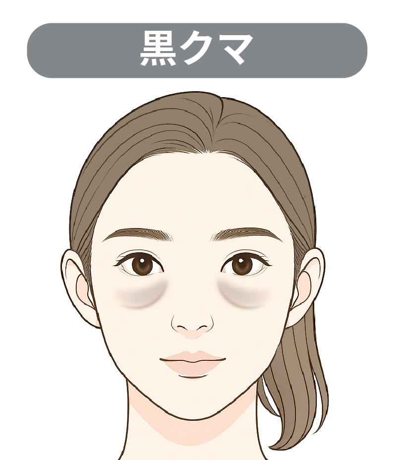 黒クマの説明画像