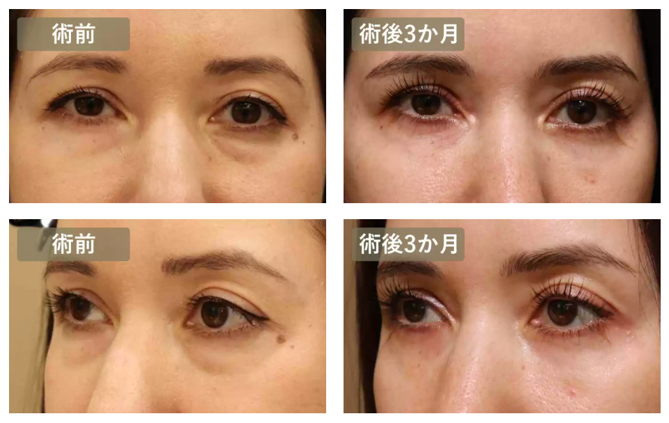 ハムラ法による症例