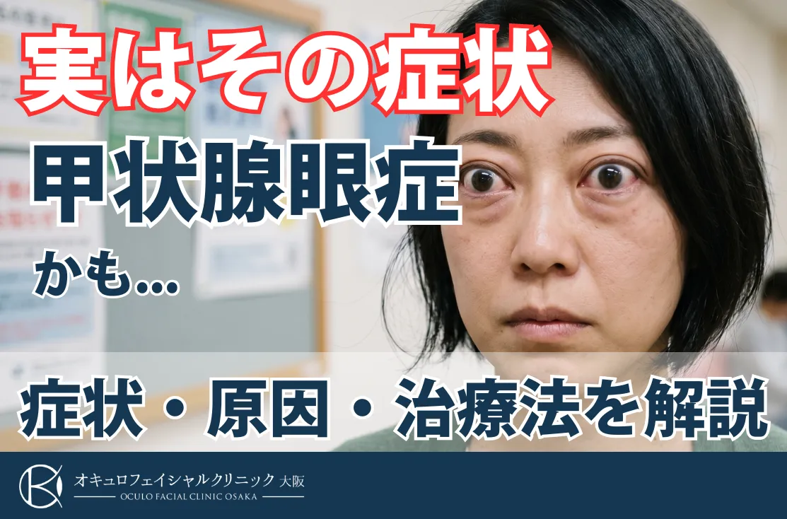 甲状腺眼症の症状と原因