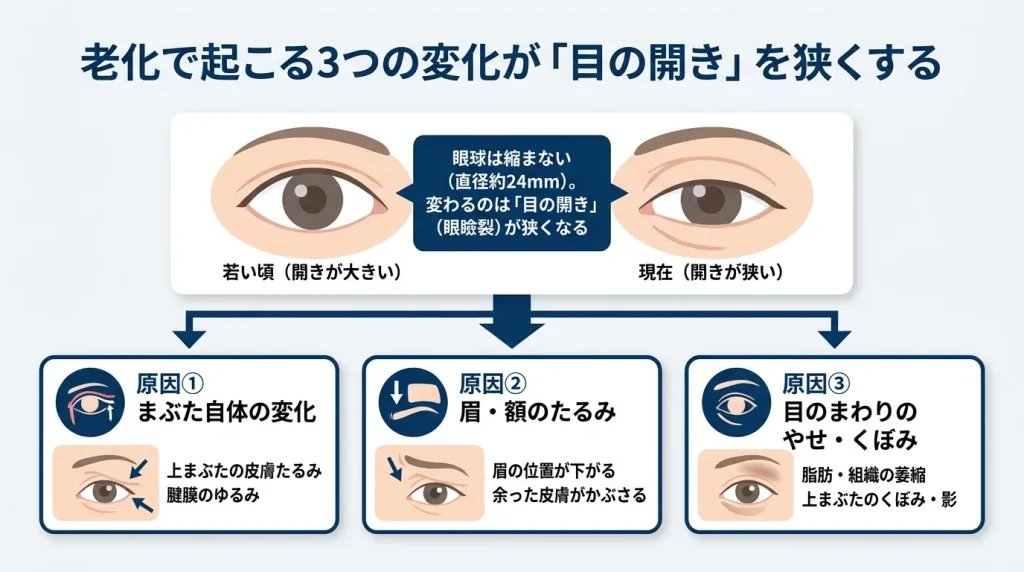 目が小さくなった3つの原因（まぶた自体の変化・眉・額のたるみ・目のまわりのやせ）が、目の開きの低下につながることを示した図