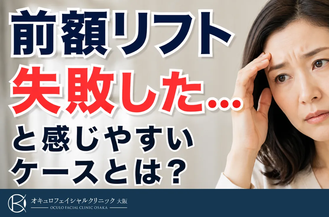 前額リフト失敗したと感じるケース