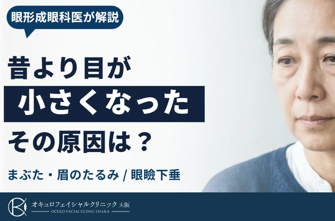 目が小さくなった・目つきが悪くなった原因と治し方を眼形成外科が解説