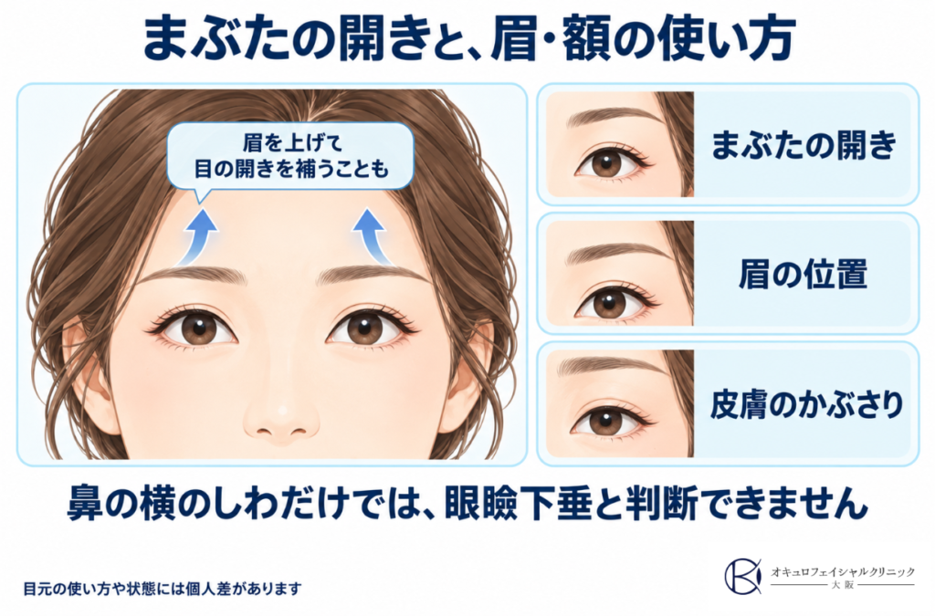 まぶたの開き方と眉額の使い方について
