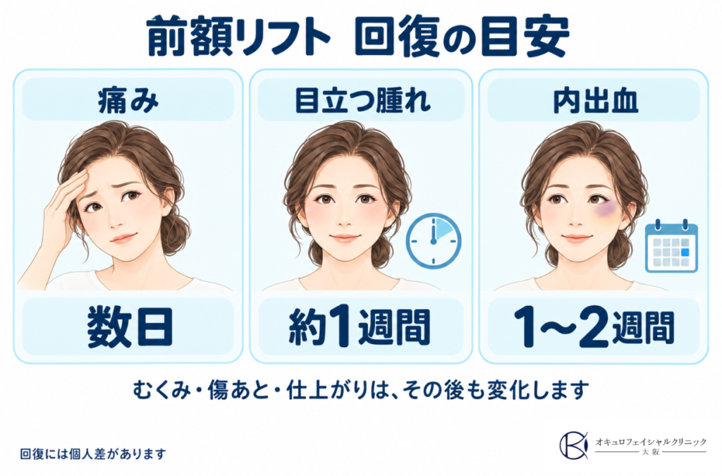 前額リフトのダウンタイムはどのくらい？
