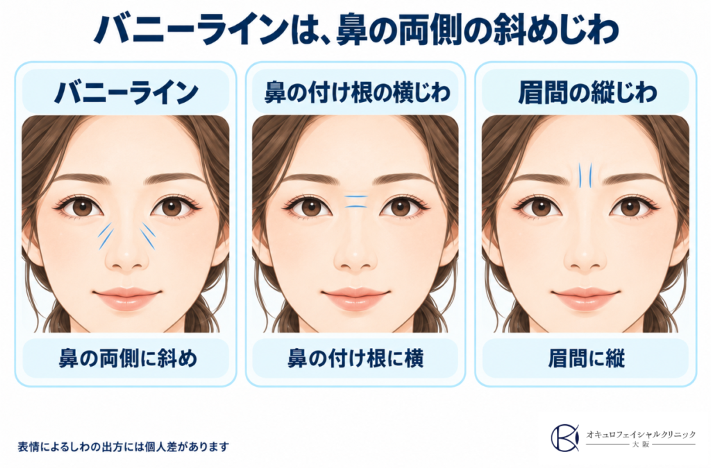 バニーラインについて図解で説明