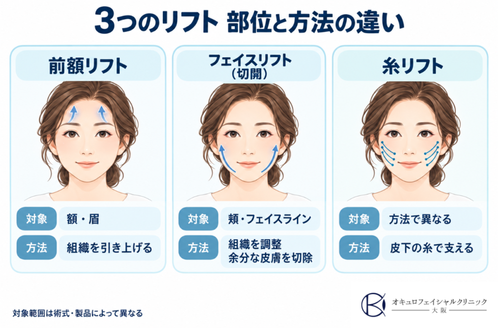 3つのリフトの施術の違い