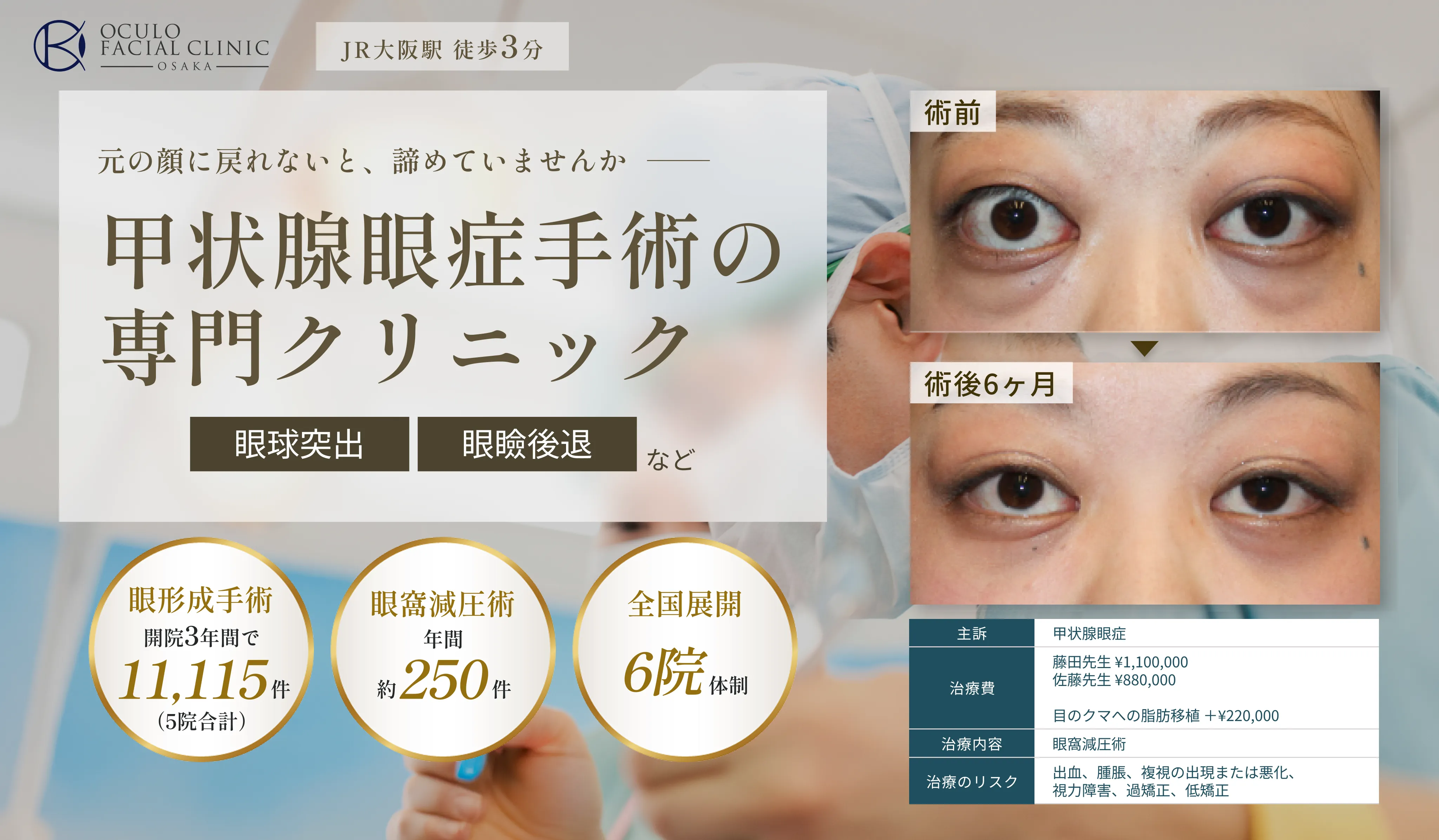 甲状腺眼症手術LP