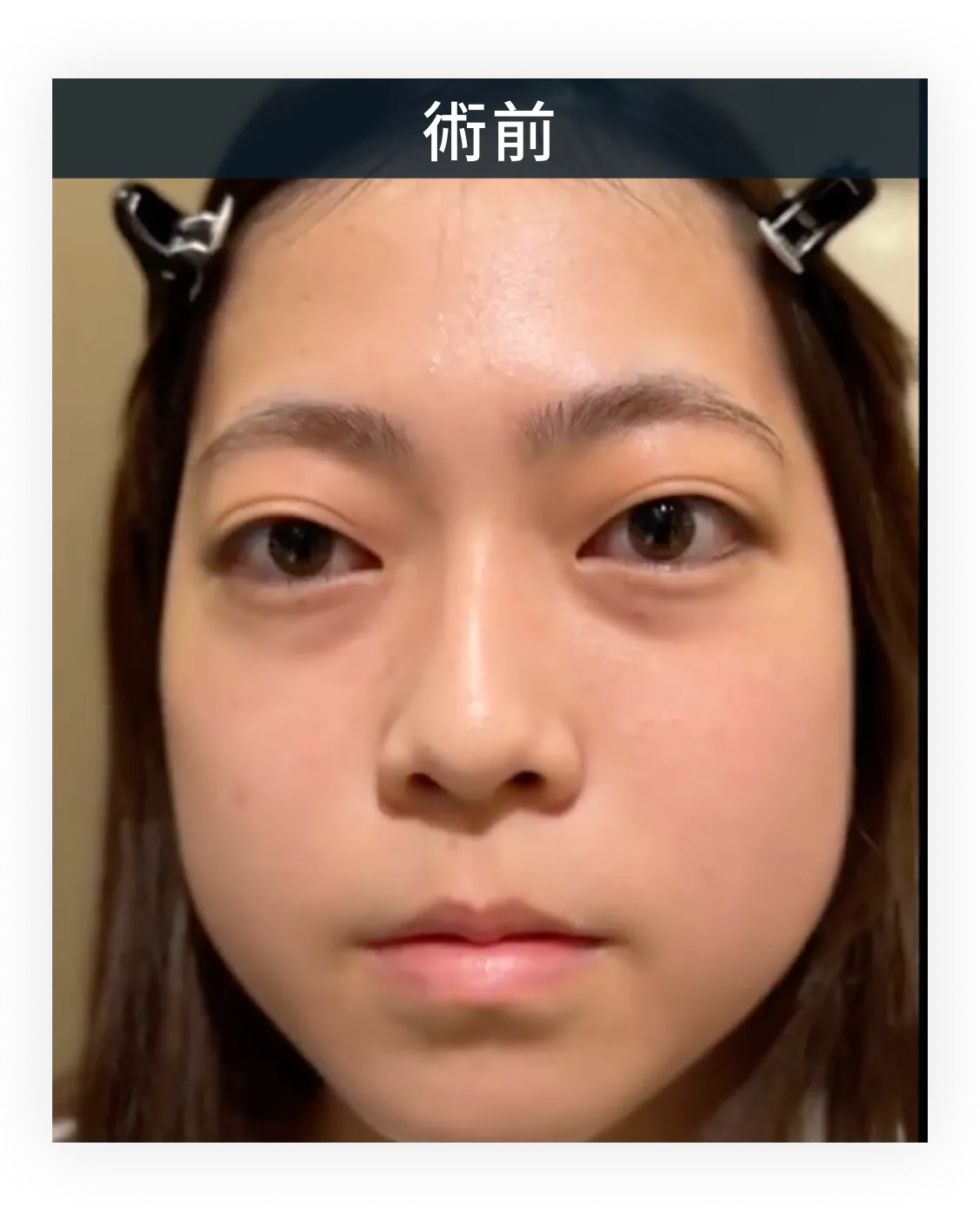 症例写真 1-1