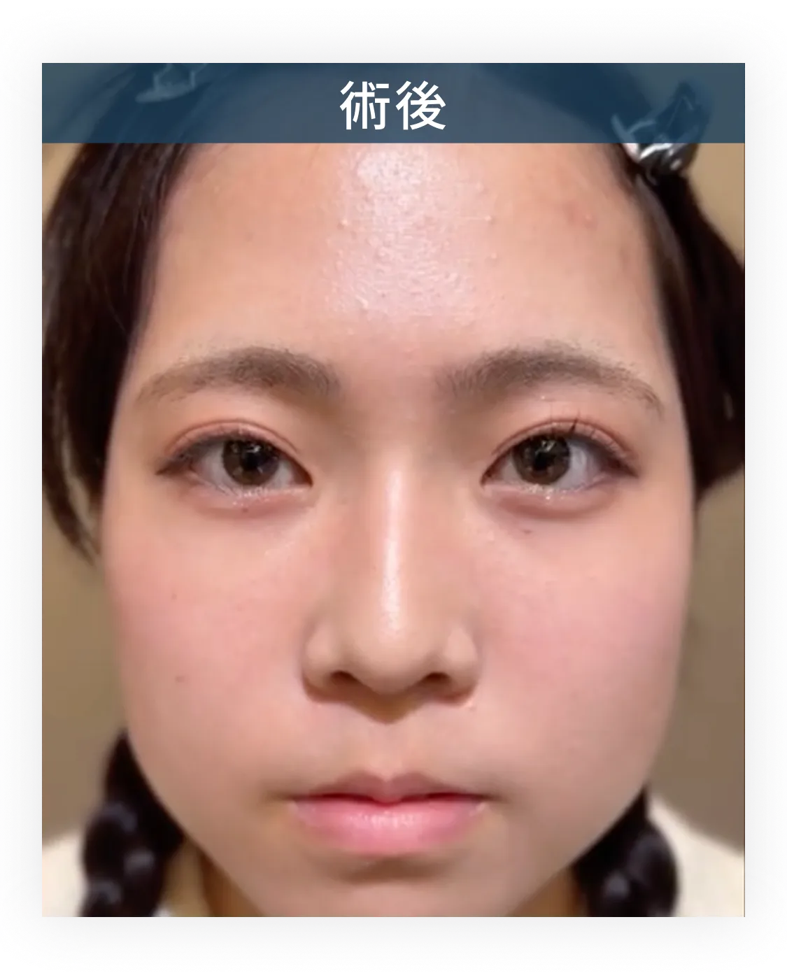 症例写真 1-2