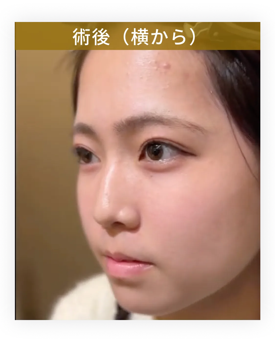 症例写真 1-3