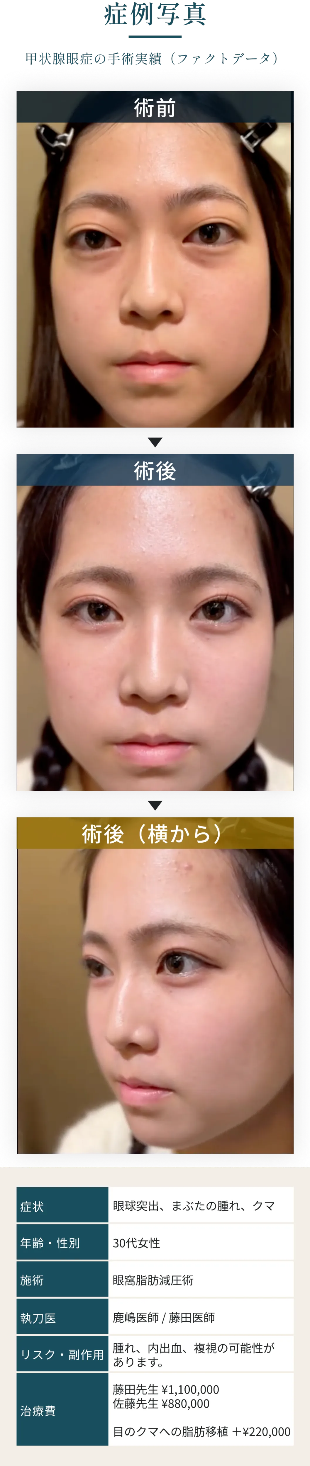 症例