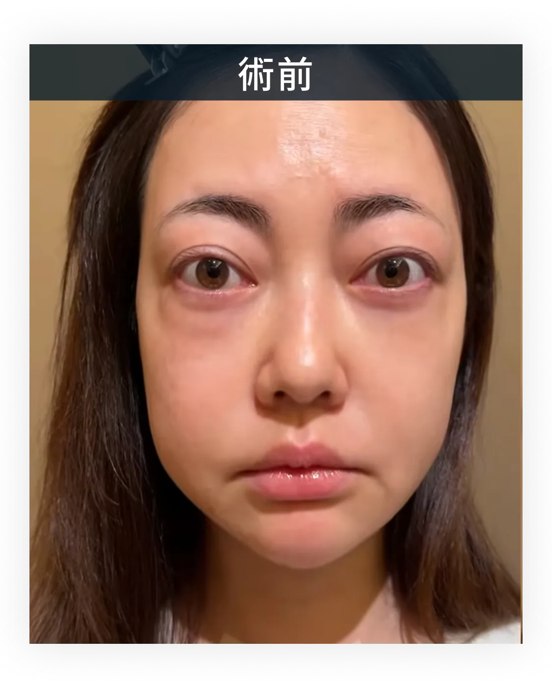 症例写真 2-1