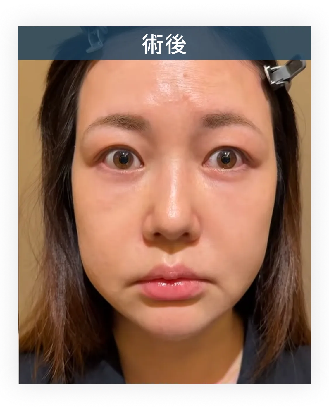 症例写真 2-2