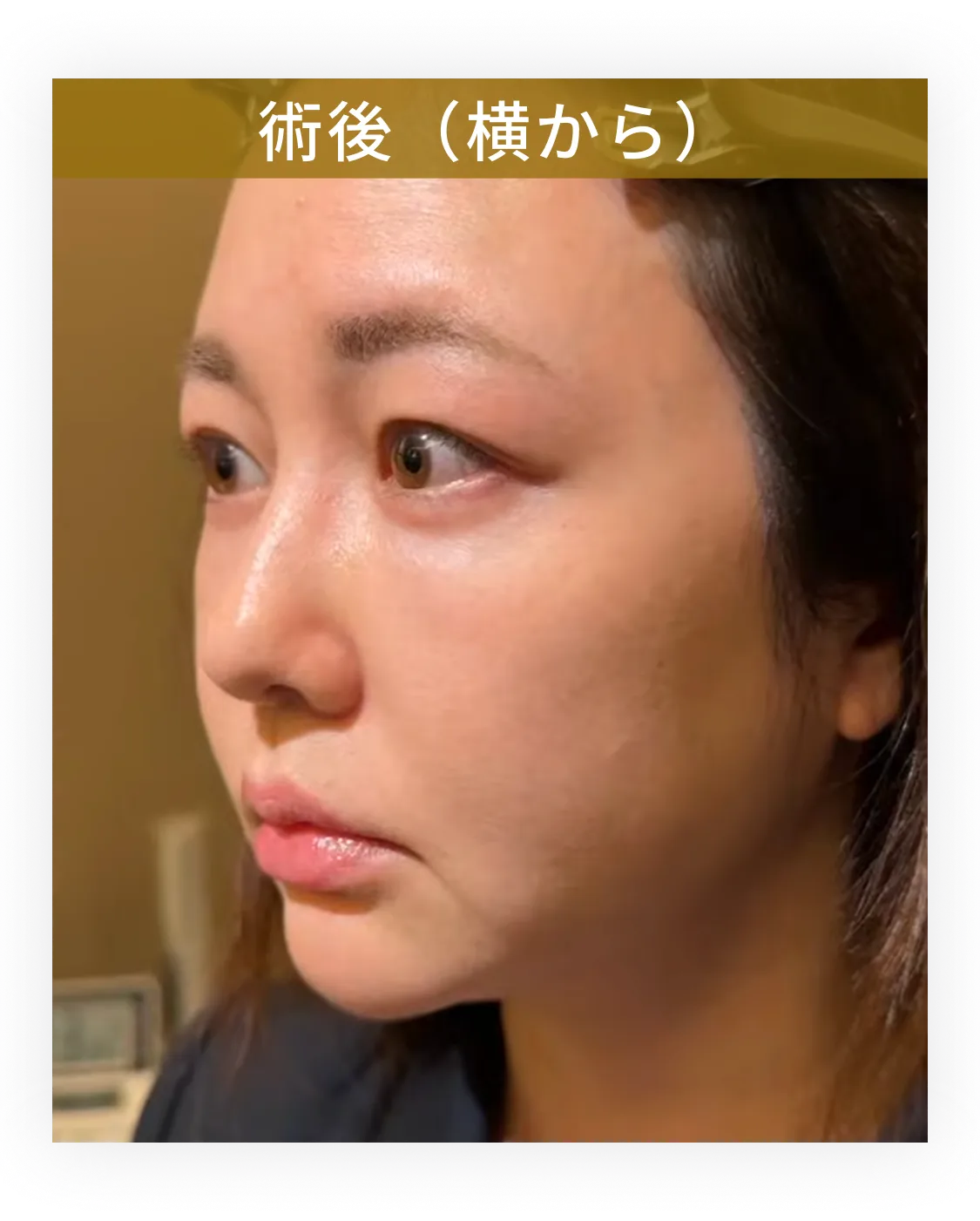 症例写真 2-3