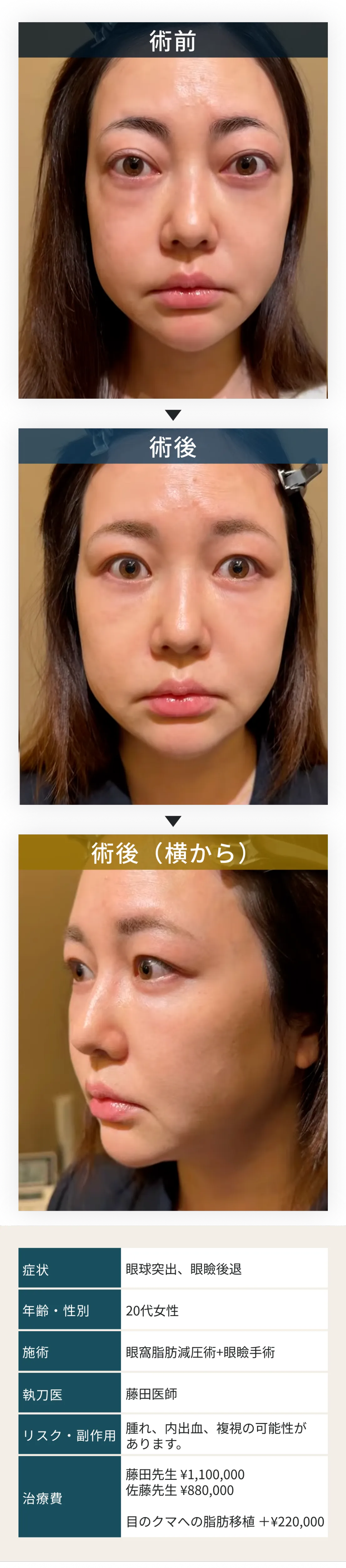 症例