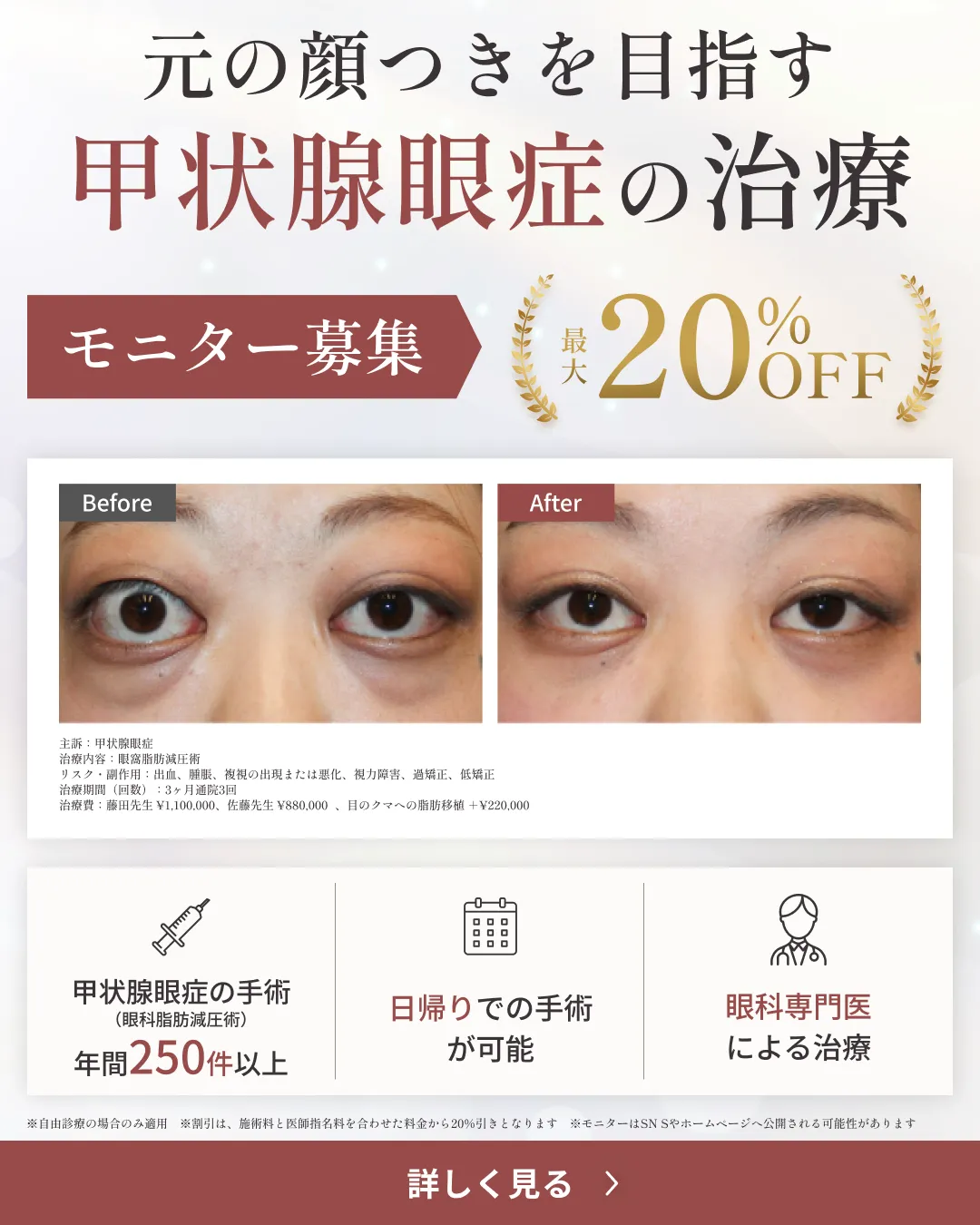 甲状腺眼症の治療 モニター募集